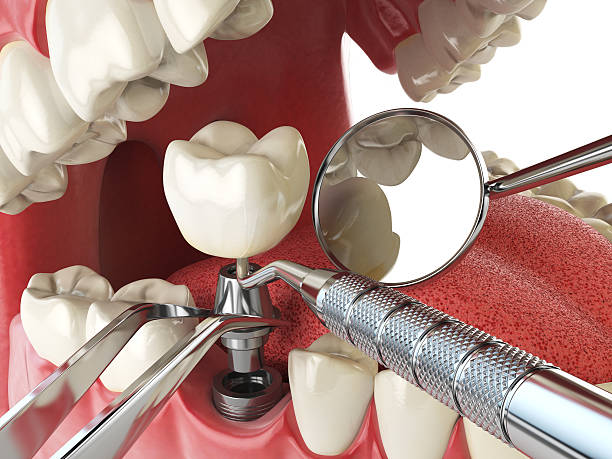 Best Mobile Emergency Dentist in Valparaiso, IN